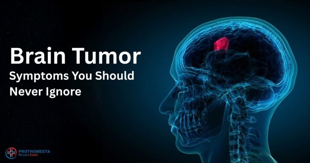 Brain Tumor Symptoms You Should Never Ignore